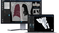 Singular Health's 3Dicom MD software