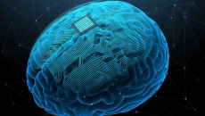 AI illustration of a brain with an implant