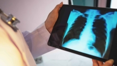 Doctor checking a chest X-ray film on a tablet