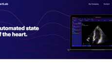 Screenshot of HeartLab website