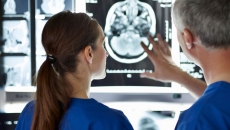 Two healthcare providers looking at a diagnostic image of a brain on a wall