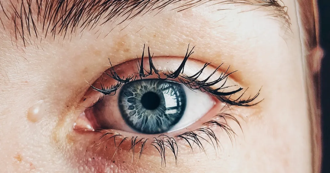 Eye