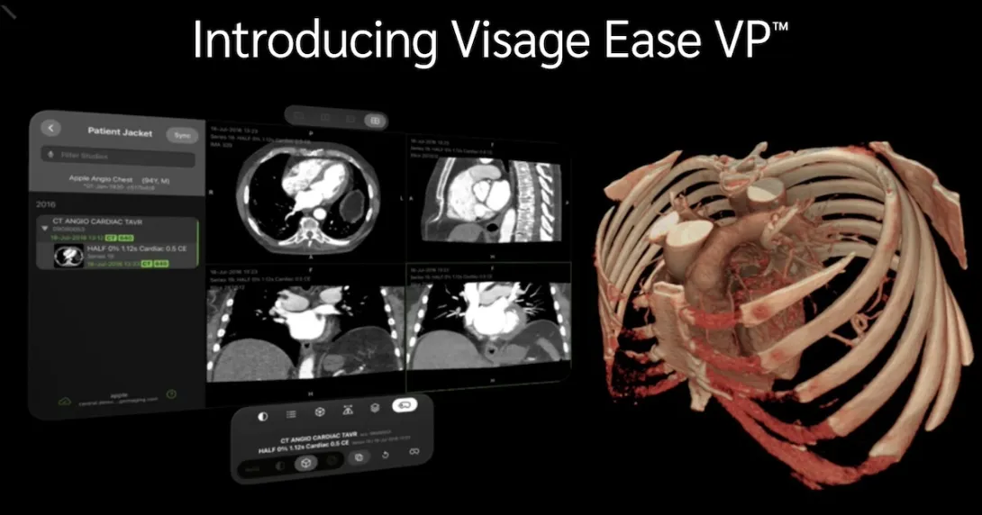 Visage Ease VP