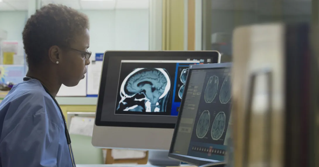 A radiologist looking at brain imaging results in a hospital.