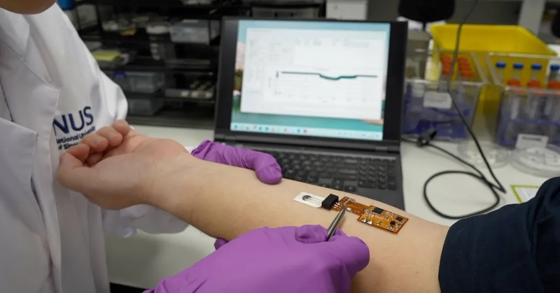 A hydrogel-based sensor detects solid-state biomarkers on the skin