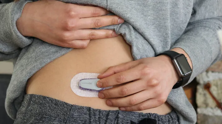 Person with a Dexcom CGM and a smartwatch