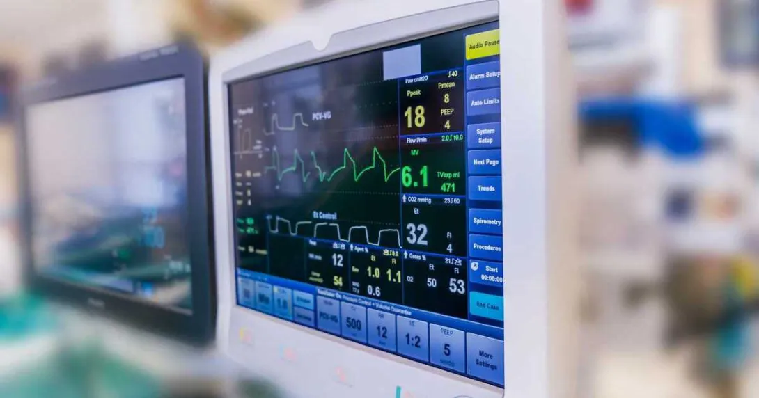 A monitor showing a patient's vital signs